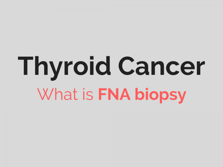 Biopsy of the Thyroid Gland Thyroid Cancer Diagnosis