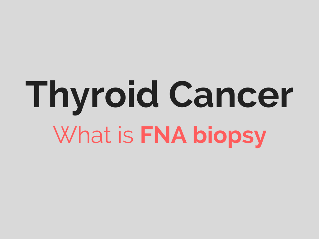 Biopsy Of The Thyroid Gland Thyroid Cancer Diagnosis